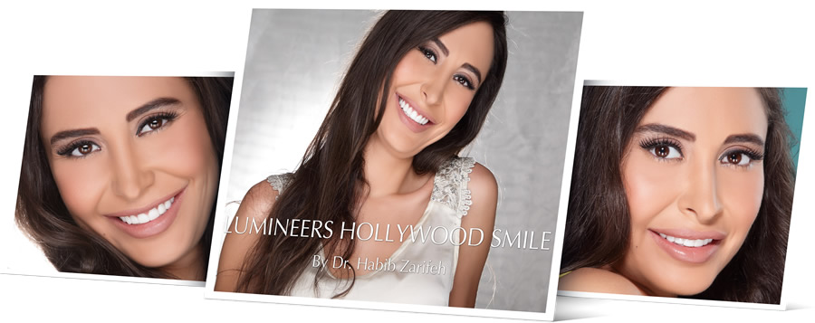 veneers dubai hollywood smile